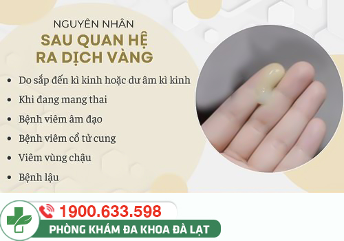 Hình ảnh minh họa
